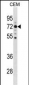 MAK Antibody (C-term)
